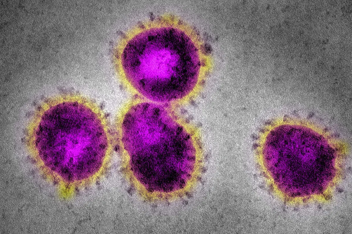 Dosar penal pentru românul care a venit cu avionul din Spania deși are coronavirus