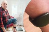 Brățară de monitorizare montată din eroare: un bărbat din Iași a vrut să se sinucidă din această cauză